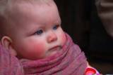 Baby Teething Remedies