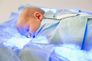 Jaundice in Newborns Jaundice Symptoms and Treatment you must know